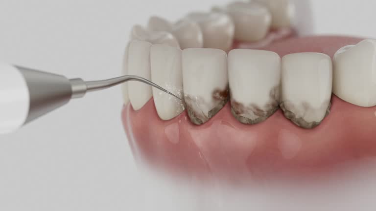 Reliable Dental Implants contractor in Menomonee Falls, WI by Smile Center Dentistry